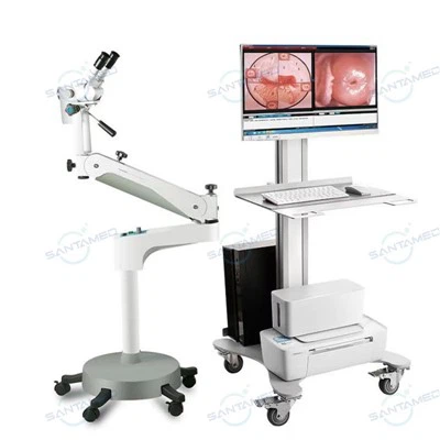 Colposcope optoelettronico
